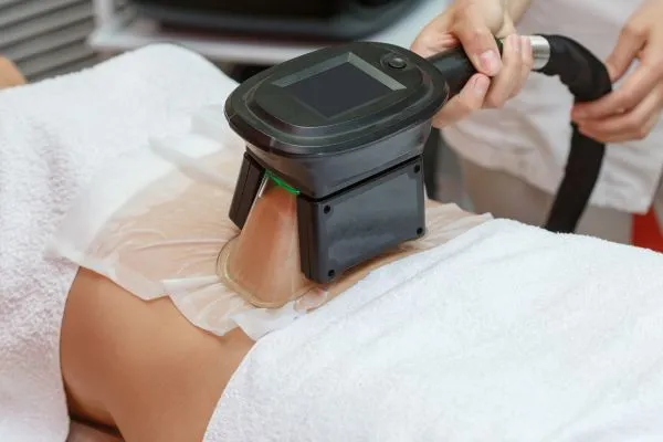 Image of person having fat freezing treatment to help weight gain Newcastle
