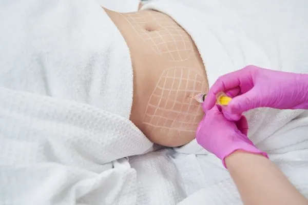 image of fat dissolving injections on love handles to help combat weight gain Newcastle