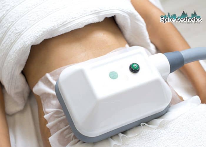 Shift Those Extra Pounds: How Fat Freezing Can Help You Slim Down Newcastle